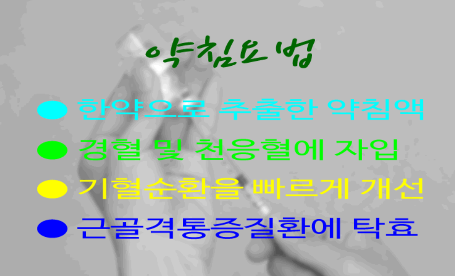 약침요법