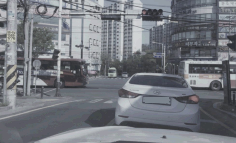 교통사고 후유증
