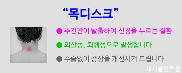 목디스크 경추디스크 경추추간판탈출증