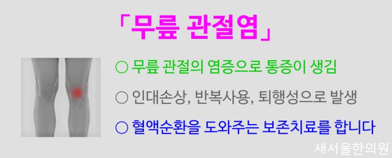Knee arthritis 무릎관절염 퇴행성관절염 슬통
