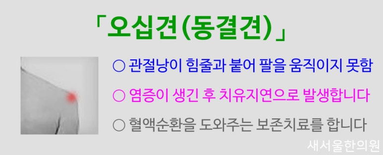 Frozen shoulder 오십견 동결견 유착성견관절낭염