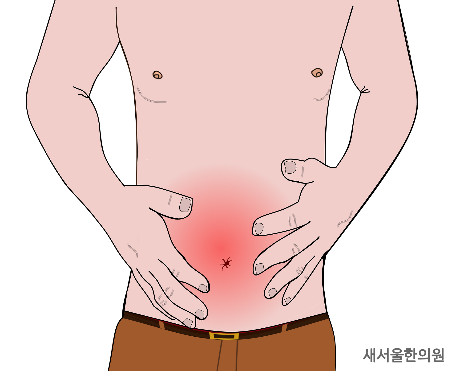 위궤양 소화성궤양 십이지장궤양